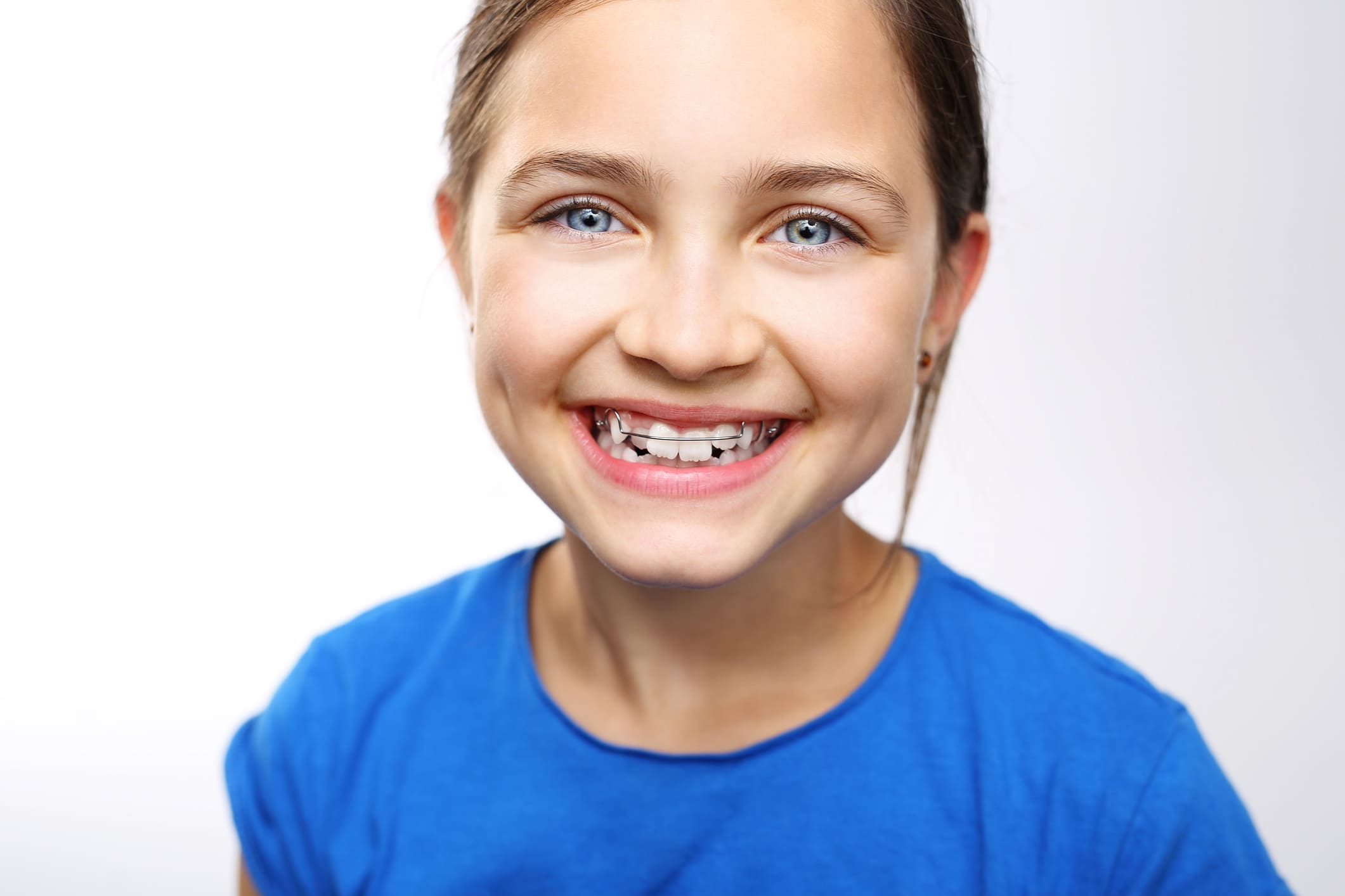 Tips for Making Braces a Positive Experience for Your Child
