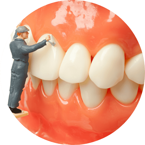 Implant Denture Cleaning