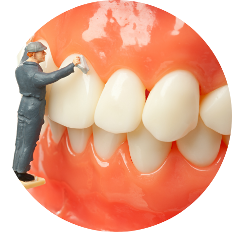 ImplantDentureCleaning Implant Denture Cleaning