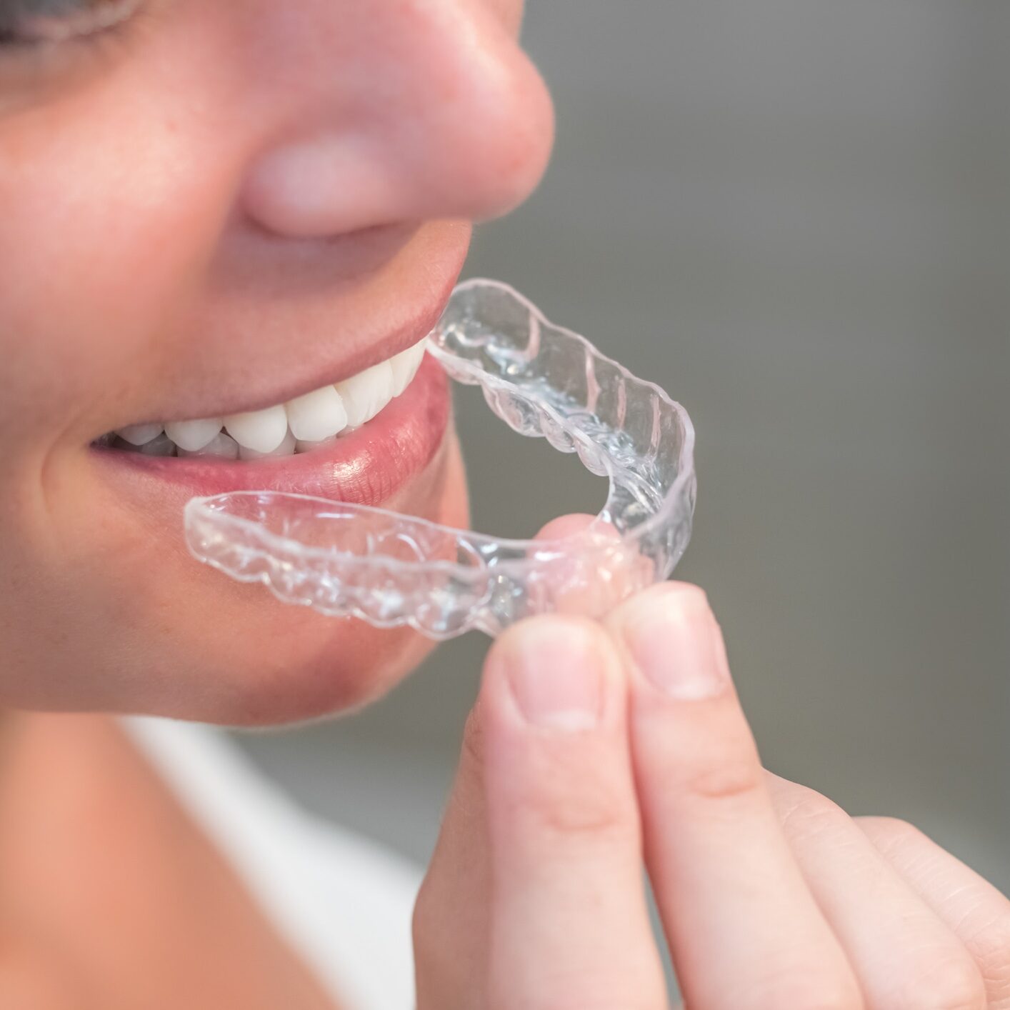 Woman wearing invisible braces aligner. mobile orthodontic appliance for dental correction.
